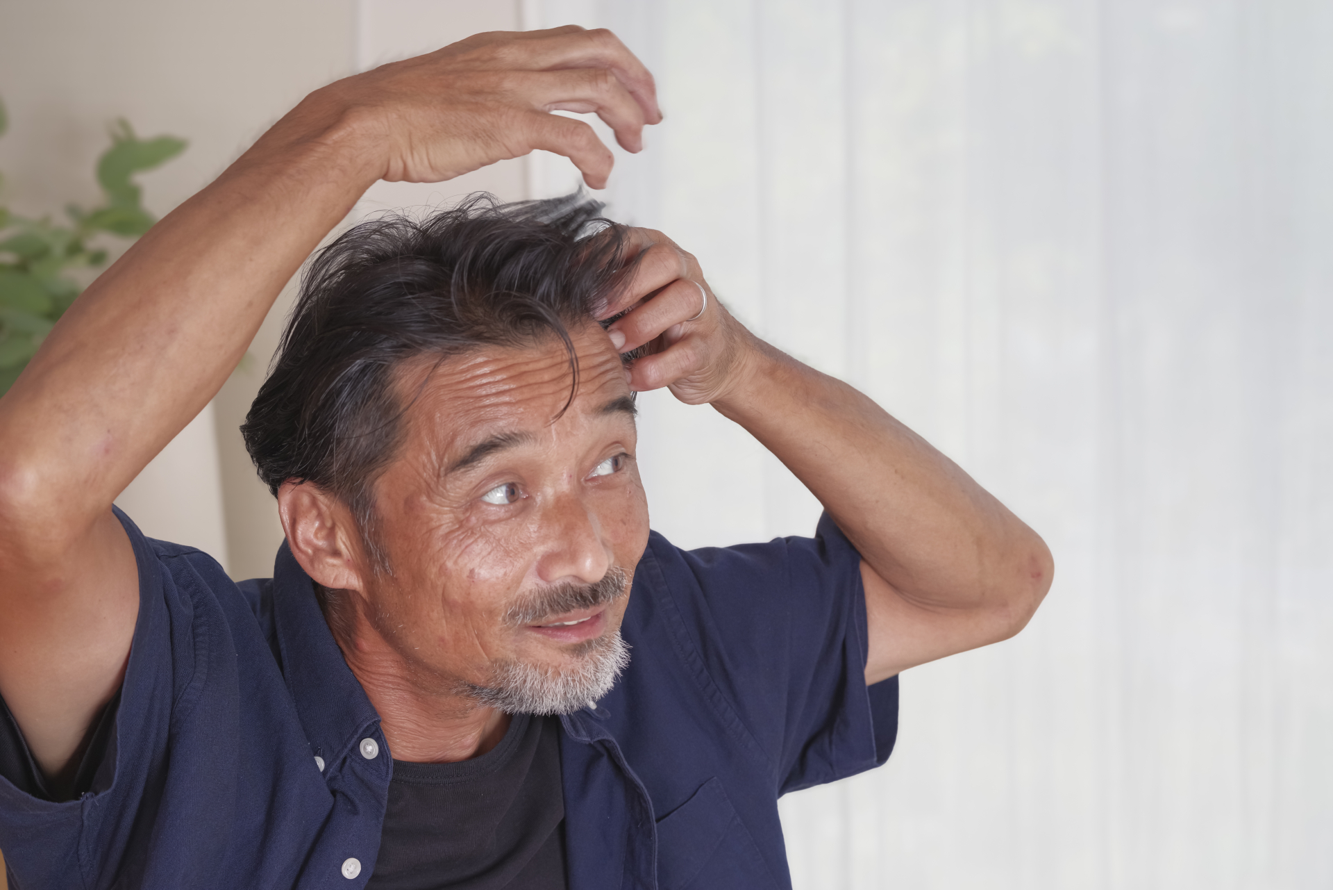「頭皮や薄毛の状態を気にしている男性」男性の頭皮ケア・薄毛。（参考イメージ）