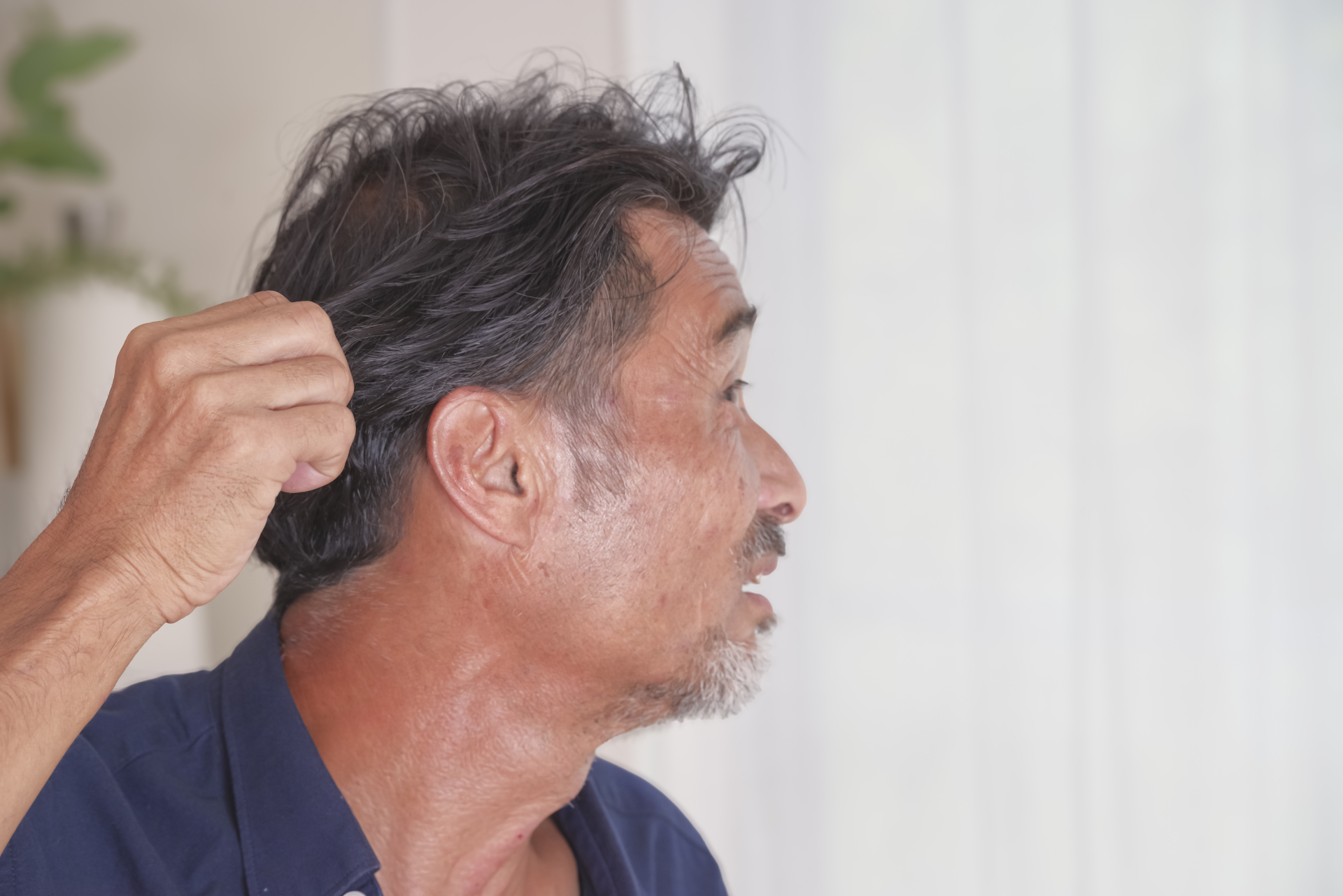 頭皮や薄毛の状態を気にしている男性（参考イメージ）