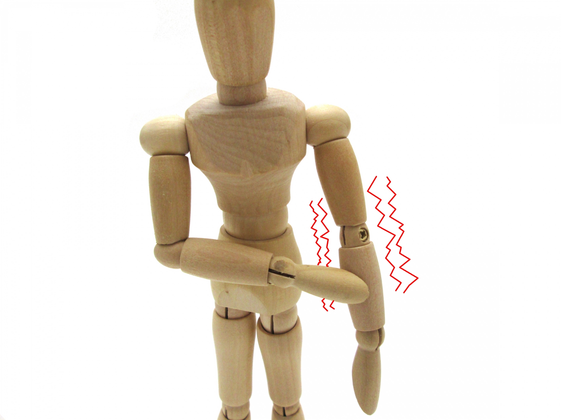 手・腕の痺れの症状